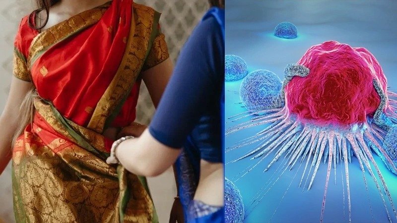 Saree Cancer