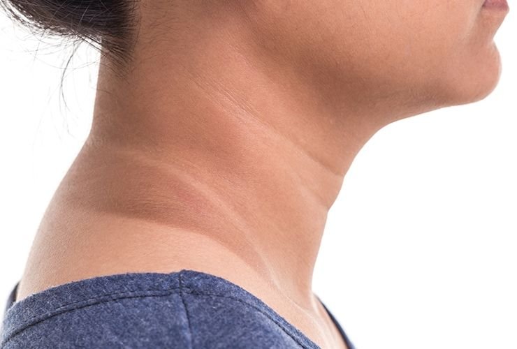 Dark neck area